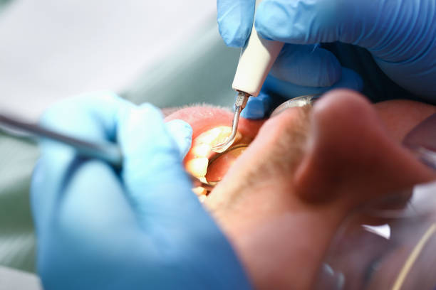 Best Emergency Treatment for Dental Infections or Abscesses in Matamoras, OH